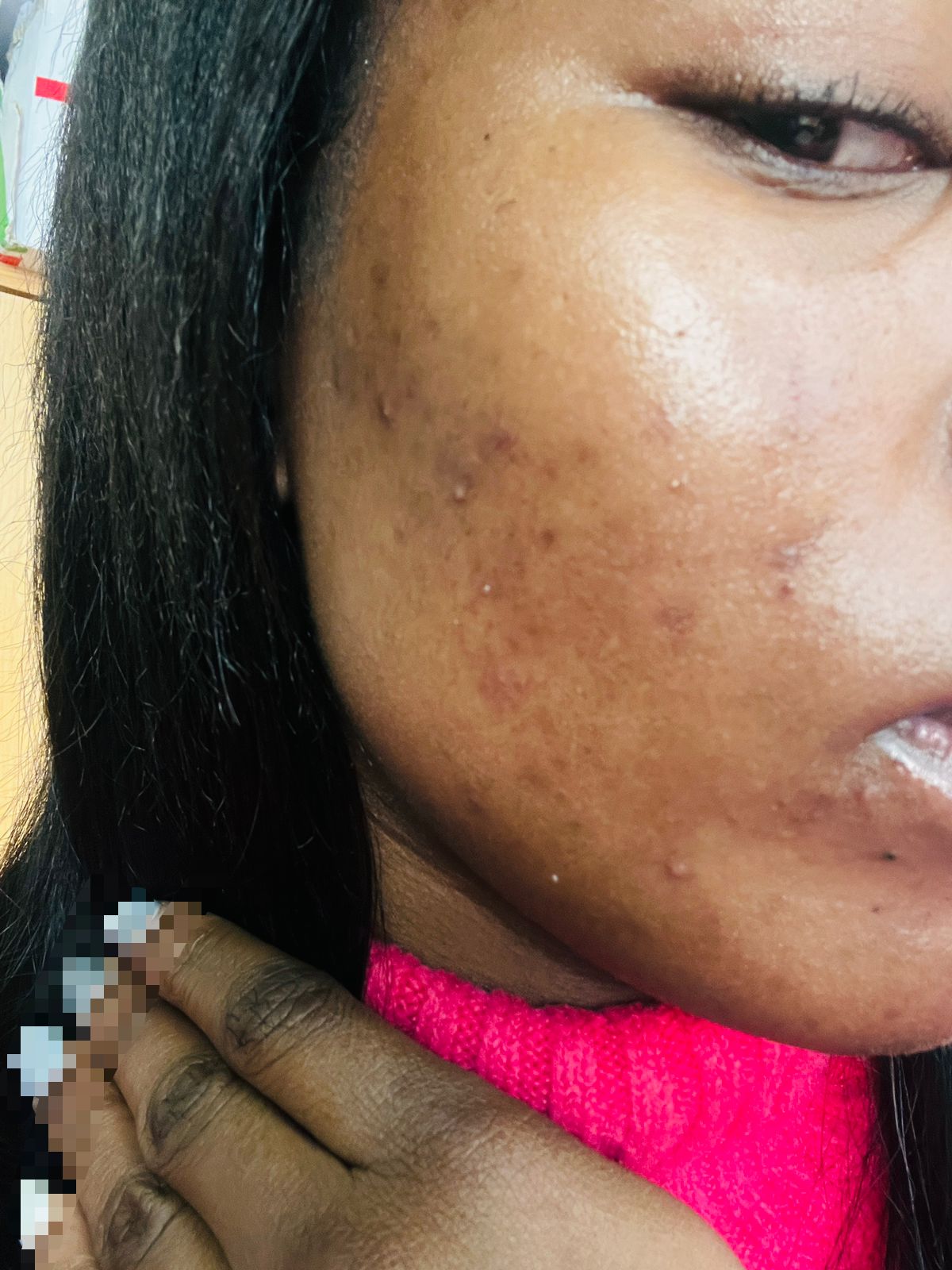 Image of a face from the side showing the results of the facial product used